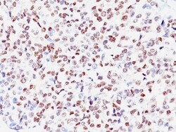 MITF Antibody (SPM290), Novus Biologicals 0.2mg; Unlabeled:Antibodies,